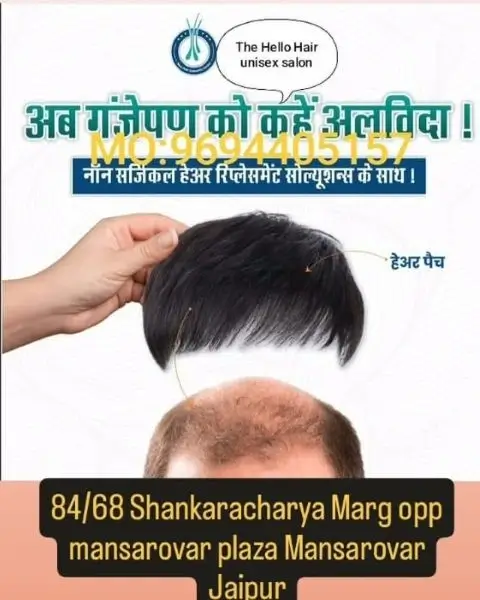 Hairfall Treatment