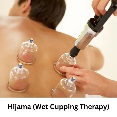 Hijama Wet Cupping Therapy At The Aastha Clinic