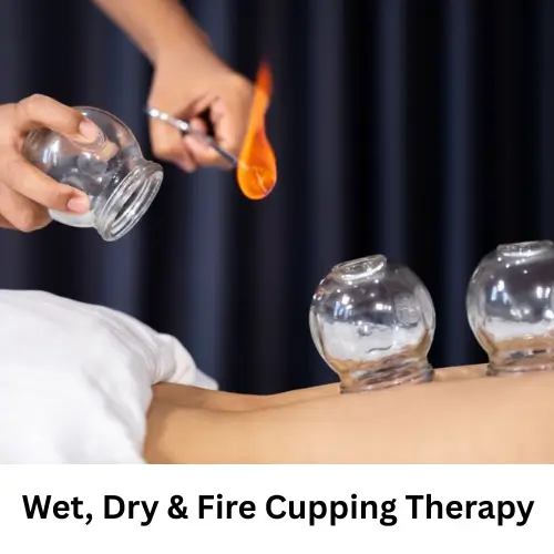 Wet Dry And Fire Cupping Therapy