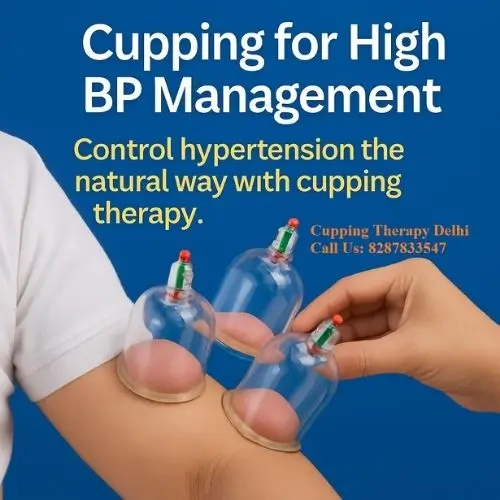 cupping blood pressure
