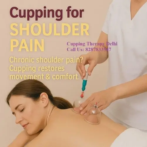 cupping shoulder pain
